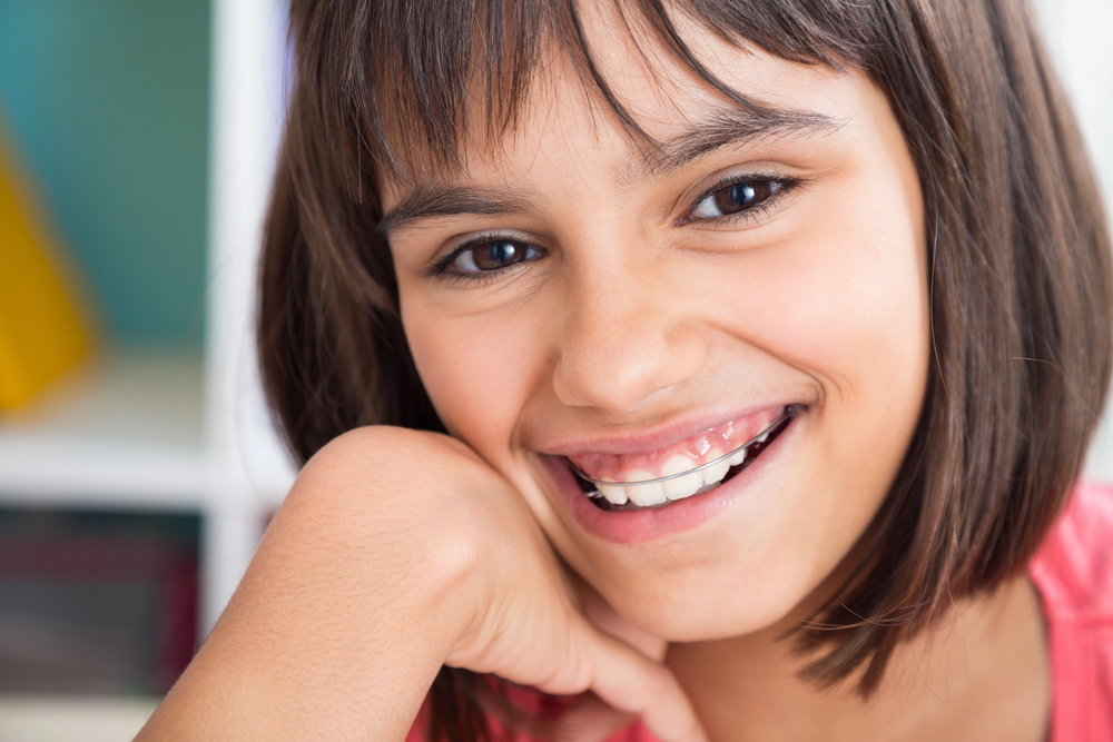 A girl undergoing orthodontic treatment smiles.