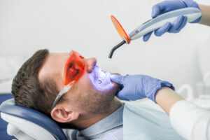 A dentist uses a tool to whiten the teeth of a patient.